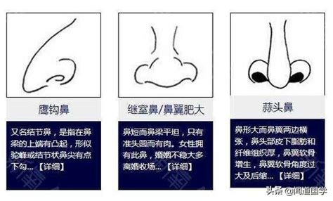 三角形鼻孔面相|鼻相分析10款｜鼻樑有節及橫紋、豬膽鼻、鼻頭下垂代 